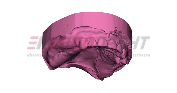 3D модель челюсти пациента, полученная путем сканирования