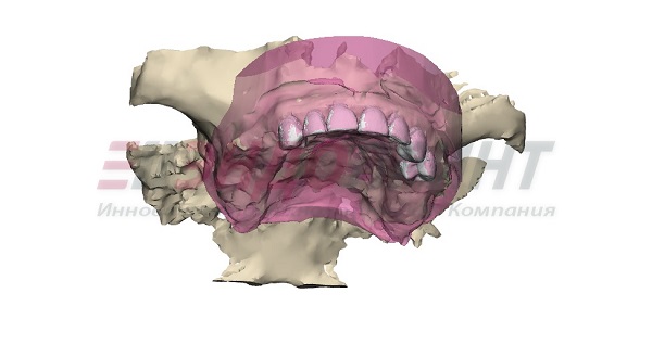 3D модель совмещения методов исследования 